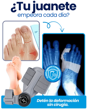 OrtoFix Pro™ Corrector de juanetes + Envío Gratis + Regalo 🎁